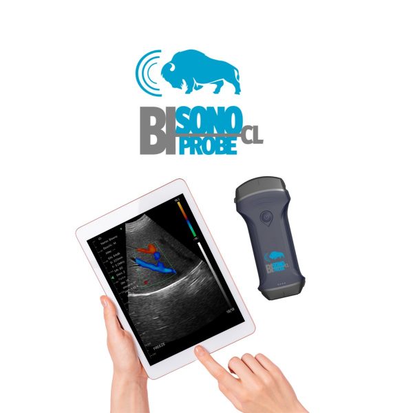 Bisono BiProbe CL – Bild 3