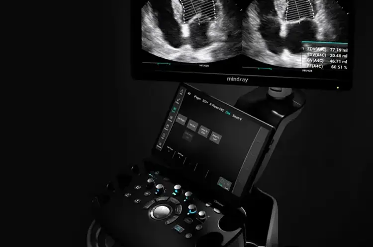 Mindray Ultraschallgerät